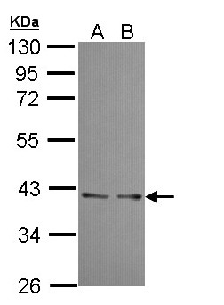 UFD1L Antibody - Sample (30 ug of whole cell lysate). A: A431 , B: H1299. 10% SDS PAGEUFD1L antibody diluted at 1:10000