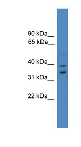 UFD1L Antibody - UFD1L antibody Western blot of MCF7 cell lysate. This image was taken for the unconjugated form of this product. Other forms have not been tested.