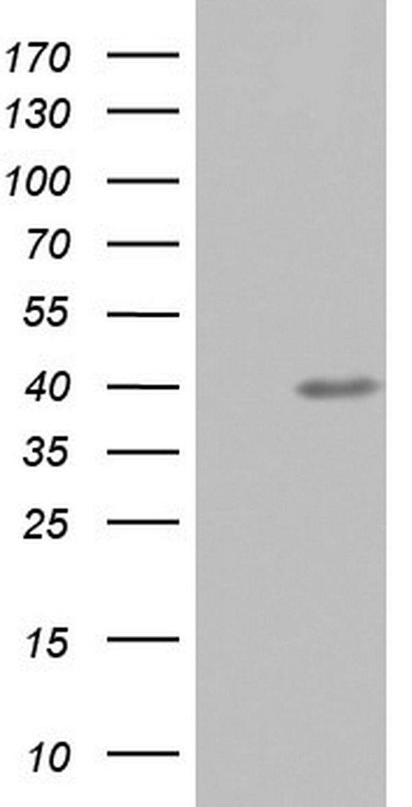 UFD1L Antibody - HEK293T cells were transfected with the pCMV6-ENTRY control (Left lane) or pCMV6-ENTRY UFD1L (Right lane) cDNA for 48 hrs and lysed. Equivalent amounts of cell lysates (5 ug per lane) were separated by SDS-PAGE and immunoblotted with anti-UFD1L.