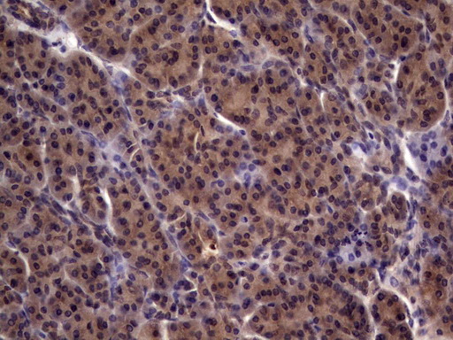 UFD1L Antibody - Immunohistochemical staining of paraffin-embedded Human pancreas tissue within the normal limits using anti-UFD1L mouse monoclonal antibody. (Heat-induced epitope retrieval by 1 mM EDTA in 10mM Tris, pH8.5, 120C for 3min,