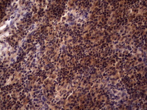 UFD1L Antibody - Immunohistochemical staining of paraffin-embedded Human lymph node tissue within the normal limits using anti-UFD1L mouse monoclonal antibody. (Heat-induced epitope retrieval by 1 mM EDTA in 10mM Tris, pH8.5, 120C for 3min,
