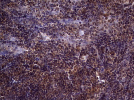 UFD1L Antibody - Immunohistochemical staining of paraffin-embedded Human tonsil within the normal limits using anti-UFD1L mouse monoclonal antibody. (Heat-induced epitope retrieval by 1 mM EDTA in 10mM Tris, pH8.5, 120C for 3min,