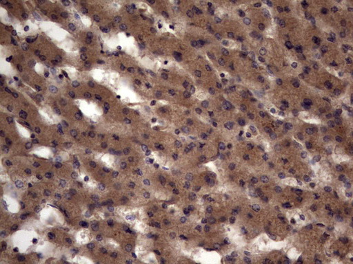 UFD1L Antibody - Immunohistochemical staining of paraffin-embedded Human liver tissue within the normal limits using anti-UFD1L mouse monoclonal antibody. (Heat-induced epitope retrieval by 1 mM EDTA in 10mM Tris, pH8.5, 120C for 3min,