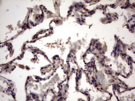 UFD1L Antibody - Immunohistochemical staining of paraffin-embedded Human lung tissue within the normal limits using anti-UFD1L mouse monoclonal antibody. (Heat-induced epitope retrieval by 1 mM EDTA in 10mM Tris, pH8.5, 120C for 3min,