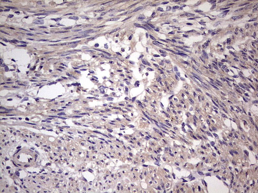 UFD1L Antibody - Immunohistochemical staining of paraffin-embedded Human endometrium tissue within the normal limits using anti-UFD1L mouse monoclonal antibody. (Heat-induced epitope retrieval by 1 mM EDTA in 10mM Tris, pH8.5, 120C for 3min,