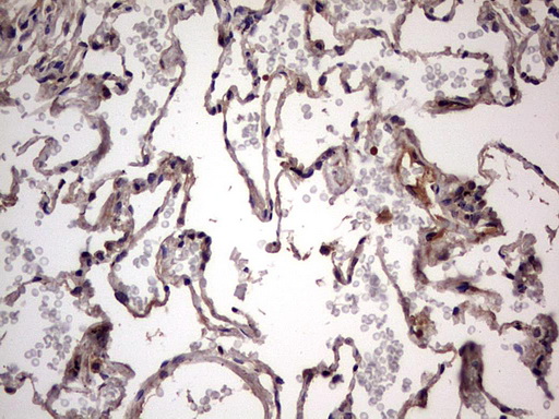 UFD1L Antibody - Immunohistochemical staining of paraffin-embedded Human lung tissue within the normal limits using anti-UFD1L mouse monoclonal antibody. (Heat-induced epitope retrieval by 1 mM EDTA in 10mM Tris, pH8.5, 120C for 3min,