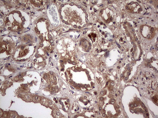 UFD1L Antibody - IHC of paraffin-embedded Human Kidney tissue using anti-UFD1L mouse monoclonal antibody. (Heat-induced epitope retrieval by 1 mM EDTA in 10mM Tris, pH8.5, 120°C for 3min).