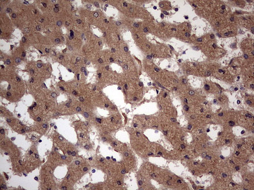 UFD1L Antibody - IHC of paraffin-embedded Human liver tissue using anti-UFD1L mouse monoclonal antibody. (Heat-induced epitope retrieval by 1 mM EDTA in 10mM Tris, pH8.5, 120°C for 3min).