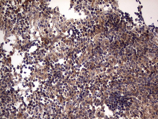 UFD1L Antibody - IHC of paraffin-embedded Human tonsil using anti-UFD1L mouse monoclonal antibody. (Heat-induced epitope retrieval by 1 mM EDTA in 10mM Tris, pH8.5, 120°C for 3min).