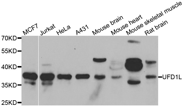 UFD1L Antibody - Western blot analysis of extracts of various cell lines.