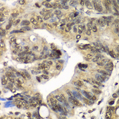 UFD1L Antibody - Immunohistochemistry of paraffin-embedded human colon tissue.