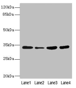 UFD1L Antibody - Western blot All Lanes:UFD1L antibody at 3.22ug/ml Lane 1:HepG2 whole cell lysate Lane 2:Raji whole cell lysate Lane 3:MCF-7 whole cell lysate Lane 4:jurkat whole cell lysate Secondary Goat polyclonal to rabbit at 1/10000 dilution Predicted band size: 35,39,30 kDa Observed band size: 35 kDa