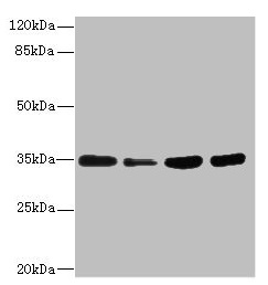 UFD1L Antibody - Western blot All lanes: UFD1 antibody at 3.22µg/ml Lane 1: HepG2 whole cell lysate Lane 2: Raji whole cell lysate Lane 3: MCF-7 whole cell lysate Lane 4: Jurkat whole cell lysate Secondary Goat polyclonal to rabbit IgG at 1/10000 dilution Predicted band size: 35, 39, 30 kDa Observed band size: 35 kDa