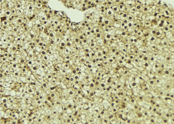 UFD1L Antibody - 1:100 staining mouse liver tissue by IHC-P. The sample was formaldehyde fixed and a heat mediated antigen retrieval step in citrate buffer was performed. The sample was then blocked and incubated with the antibody for 1.5 hours at 22°C. An HRP conjugated goat anti-rabbit antibody was used as the secondary.