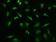 UFD1L Antibody - Immunofluorescence staining of UFD1L in Hela cells. Cells were fixed with 4% PFA, permeabilzed with 0.1% Triton X-100 in PBS, blocked with 10% serum, and incubated with rabbit anti-Human UFD1L polyclonal antibody (dilution ratio 1:100) at 4°C overnight. Then cells were stained with the Alexa Fluor 488-conjugated Goat Anti-rabbit IgG secondary antibody (green). Positive staining was localized to Nucleus and Cytoplasm.