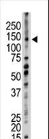 UFD2A / UBE4B Antibody - The anti-UBE4B antibody is used in Western blot to detect UBE4B in mouse kidney tissue lysate.