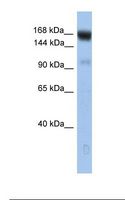 UFD2A / UBE4B Antibody - Fetal brain lysate. Antibody concentration: 1.0 ug/ml. Gel concentration: 6-18%.  This image was taken for the unconjugated form of this product. Other forms have not been tested.