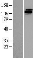 UFD2A / UBE4B Protein - Western validation with an anti-DDK antibody * L: Control HEK293 lysate R: Over-expression lysate