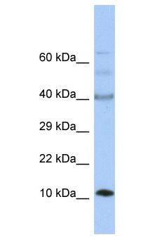 UFSP1 Antibody - UFSP1 antibody Western Blot of Fetal Small Intestine. Antibody dilution: 1 ug/ml.  This image was taken for the unconjugated form of this product. Other forms have not been tested.