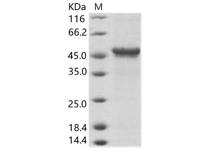 Uganda Ebola Virus Glycoprotein Protein - Recombinant EBOV (subtype Bundibugyo, strain Uganda 2007) GP-RBD / Glycoprotein Protein (Fc Tag)