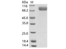 Uganda Ebola Virus Glycoprotein Protein - Recombinant EBOV (subtype Bundibugyo, strain Uganda 2007) Glycoprotein / GP-RBD Protein (Fc Tag)