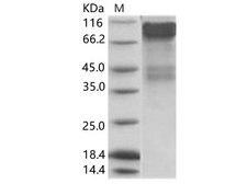 Uganda Ebola Virus GP1 Protein - Recombinant EBOV (subtype Bundibugyo, strain Uganda 2007) GP1 / Glycoprotein Protein (His Tag)