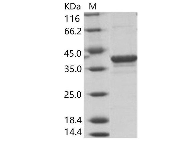 Uganda Ebola Virus Matrix Protein VP40 Protein - Recombinant EBOV (subtype Bundibugyo, strain Uganda 2007) VP40 / Matrix protein VP40 Protein (His Tag)