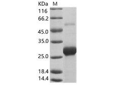 Uganda Ebola Virus VP24 Protein - Recombinant EBOV (subtype Bundibugyo, strain Uganda 2007) VP24 Protein (His Tag)