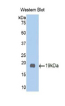 UGCG Antibody - Western blot of recombinant GCS / UGCG.  This image was taken for the unconjugated form of this product. Other forms have not been tested.