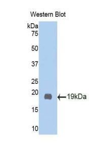 UGCG Antibody - Western blot of recombinant GCS / UGCG.  This image was taken for the unconjugated form of this product. Other forms have not been tested.