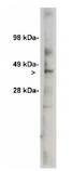 UGCG Antibody - Western blot of Ceramide Glycosyltransferase antibody (Ceramide Glycosyltransferase) on 7 ug of rat kidney lysate. Antibody used at 1 ug/ml.