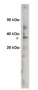 UGCG Antibody - Western blot of Ceramide Glycosyltransferase antibody (Ceramide Glycosyltransferase) on 7 ug of rat kidney lysate. Antibody used at 1 ug/ml.