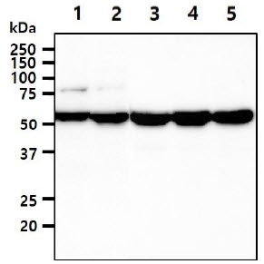 UGDH / UDPGDH Antibody - The cell lysates (40ug) were resolved by SDS-PAGE, transferred to PVDF membrane and probed with anti-human UGDH antibody (1:1000). Proteins were visualized using a goat anti-mouse secondary antibody conjugated to HRP and an ECL detection system. Lane 1.: HeLa cell lysate Lane 2.: NIH-3T3 cell lysate Lane 3.: HepG2 cell lysate Lane 4.: A549 cell lysate Lane 5.: MCF7 cell lysate