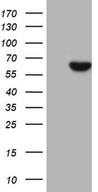 UGDH / UDPGDH Antibody - HEK293T cells were transfected with the pCMV6-ENTRY control. (Left lane) or pCMV6-ENTRY UGDH. (Right lane) cDNA for 48 hrs and lysed. Equivalent amounts of cell lysates. (5 ug per lane) were separated by SDS-PAGE and immunoblotted with anti-UGDH. (1:2000)