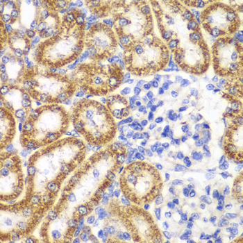 UGDH / UDPGDH Antibody - Immunohistochemistry of paraffin-embedded rat kidney tissue.