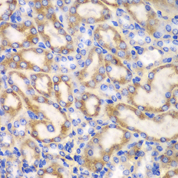 UGDH / UDPGDH Antibody - Immunohistochemistry of paraffin-embedded mouse kidney tissue.