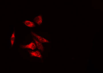UGDH / UDPGDH Antibody - Staining COLO205 cells by IF/ICC. The samples were fixed with PFA and permeabilized in 0.1% Triton X-100, then blocked in 10% serum for 45 min at 25°C. The primary antibody was diluted at 1:200 and incubated with the sample for 1 hour at 37°C. An Alexa Fluor 594 conjugated goat anti-rabbit IgG (H+L) antibody, diluted at 1/600, was used as secondary antibody.