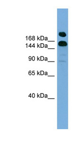 UGGT1 / UGGT Antibody - UGGT1 / UGCGL1 antibody Western blot of HepG2 cell lysate. This image was taken for the unconjugated form of this product. Other forms have not been tested.