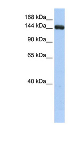 UGGT2 Antibody - UGGT2 / UGCGL2 antibody Western blot of HepG2 cell lysate. This image was taken for the unconjugated form of this product. Other forms have not been tested.