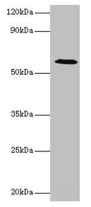 UGP2 Antibody - Western blot All lanes: UTP--glucose-1-phosphate uridylyltransferase antibody at 2µg/ml + Mouse liver tissue Secondary Goat polyclonal to rabbit IgG at 1/10000 dilution Predicted band size: 57, 56 kDa Observed band size: 57 kDa