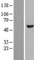 UGP2 Protein - Western validation with an anti-DDK antibody * L: Control HEK293 lysate R: Over-expression lysate