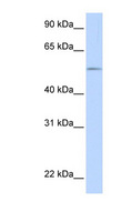 UGT1A / UGT1A1 Antibody - UGT1A1 antibody Western blot of Fetal Muscle lysate. This image was taken for the unconjugated form of this product. Other forms have not been tested.
