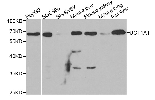 UGT1A / UGT1A1 Antibody - Western blot analysis of extracts of various cell lines, using UGT1A1 antibody.