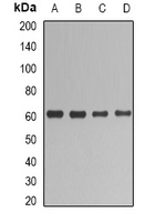 UGT1A / UGT1A1 Antibody - Western blot analysis of UGT1A1 expression in HepG2 (A); SHSY5Y (B); mouse liver (C); rat liver (D) whole cell lysates.
