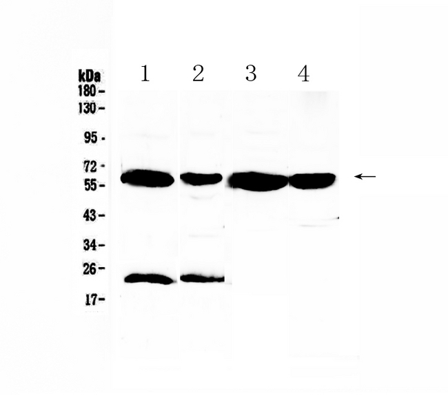 UGT1A / UGT1A1 Antibody - Western blot - Anti-UGT1A1 Picoband antibody