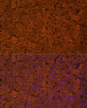 UGT1A / UGT1A1 Antibody - Immunofluorescence analysis of Rat liver using UGT1A1 Polyclonal Antibody at dilution of 1:100.Blue: DAPI for nuclear staining.