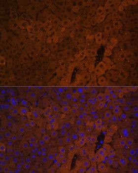 UGT1A / UGT1A1 Antibody - Immunofluorescence analysis of Mouse liver using UGT1A1 Polyclonal Antibody at dilution of 1:100.Blue: DAPI for nuclear staining.