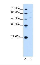 UGT1A4 Antibody - Lane A: Marker. Lane B: HepG2 cell lysate. Antibody concentration: 1.0 ug/ml. Gel concentration: 12%.  This image was taken for the unconjugated form of this product. Other forms have not been tested.