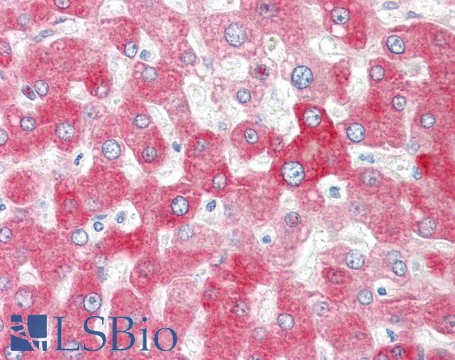 UGT1A4 Antibody - Anti-UGT1A4 antibody IHC of human liver. Immunohistochemistry of formalin-fixed, paraffin-embedded tissue after heat-induced antigen retrieval. Antibody dilution 2.5-5 ug/ml. This image was taken for the unconjugated form of this product. Other forms have not been tested.