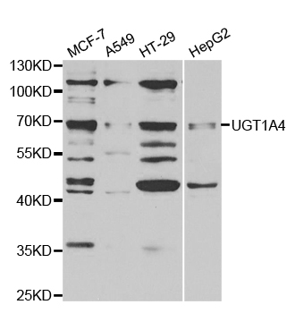 UGT1A4 Antibody - Western blot analysis of extracts of various cell lines.
